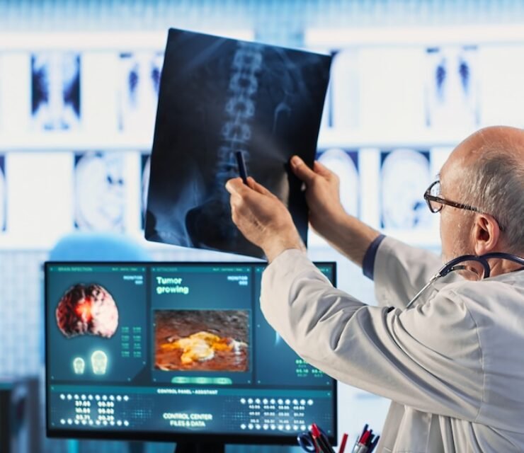 How to Become a Radiologist?Salary & Future Scope
